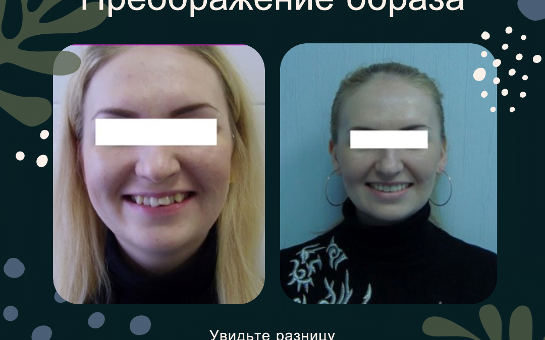 Преображение образа