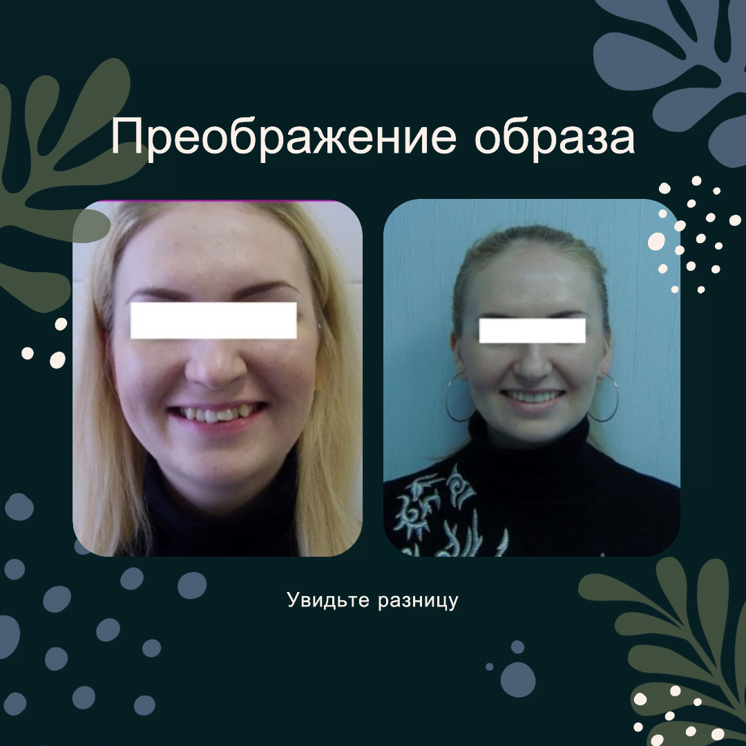 Преображение образа