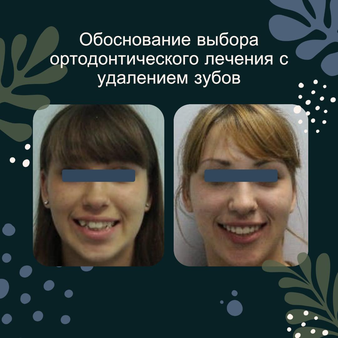 before-after-treatment