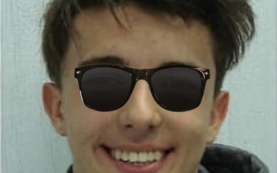 Как избежать удаления здоровых зубов при коррекции неправильного прикуса